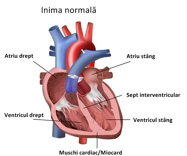 Правое предсердие аорта левый желудочек легкие левое. Синдром спортивного сердца. Спортивное сердце. Сердце спортсмена отличие от здорового. Выброс крови из левого желудочка.
